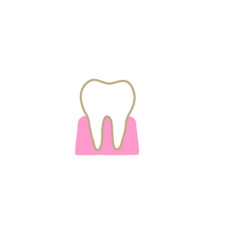 Gencives et parodontologie