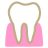Gencives et parodontologie