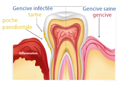 parodontologie